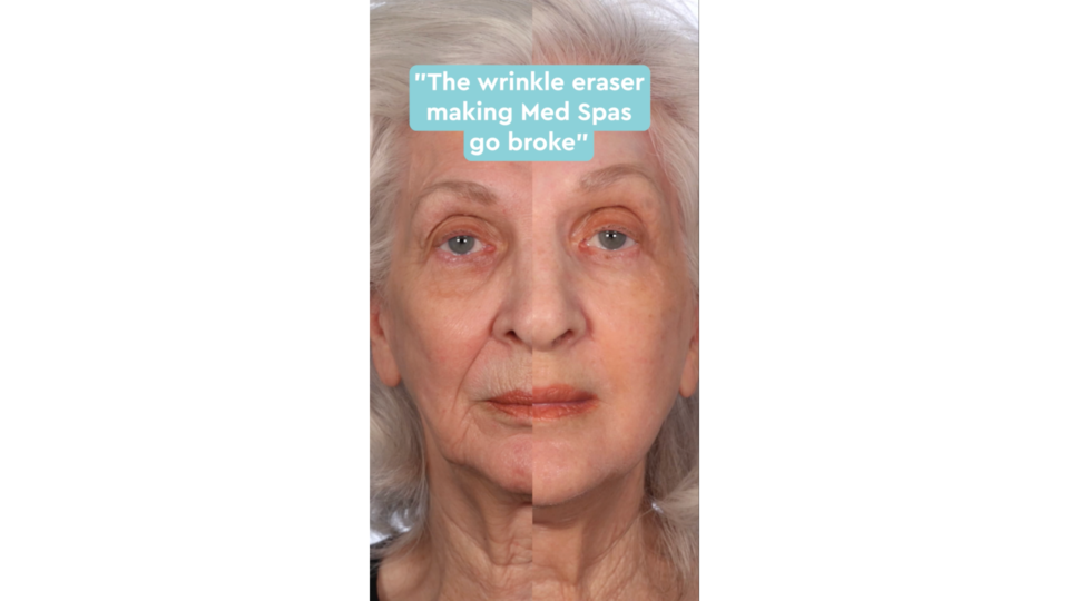 InstaTox Direct Response Ad